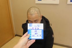 -大麦微针植发丨全国连锁