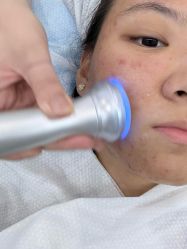 -悟空祛痘·诺奖技术专业店