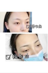 -久匠·纹眉纹绣半永久