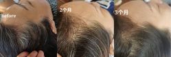 点击看大图 -舒欣头疗·俏丝谧语 白发脱发专业护理