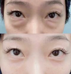 -幼泡泡连锁美容医疗