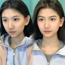 点击看大图 -杨益美学·野生眉半永久纹眉发际线