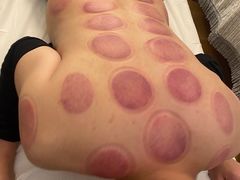 -蓉城阳光推拿馆(羊子山路店)