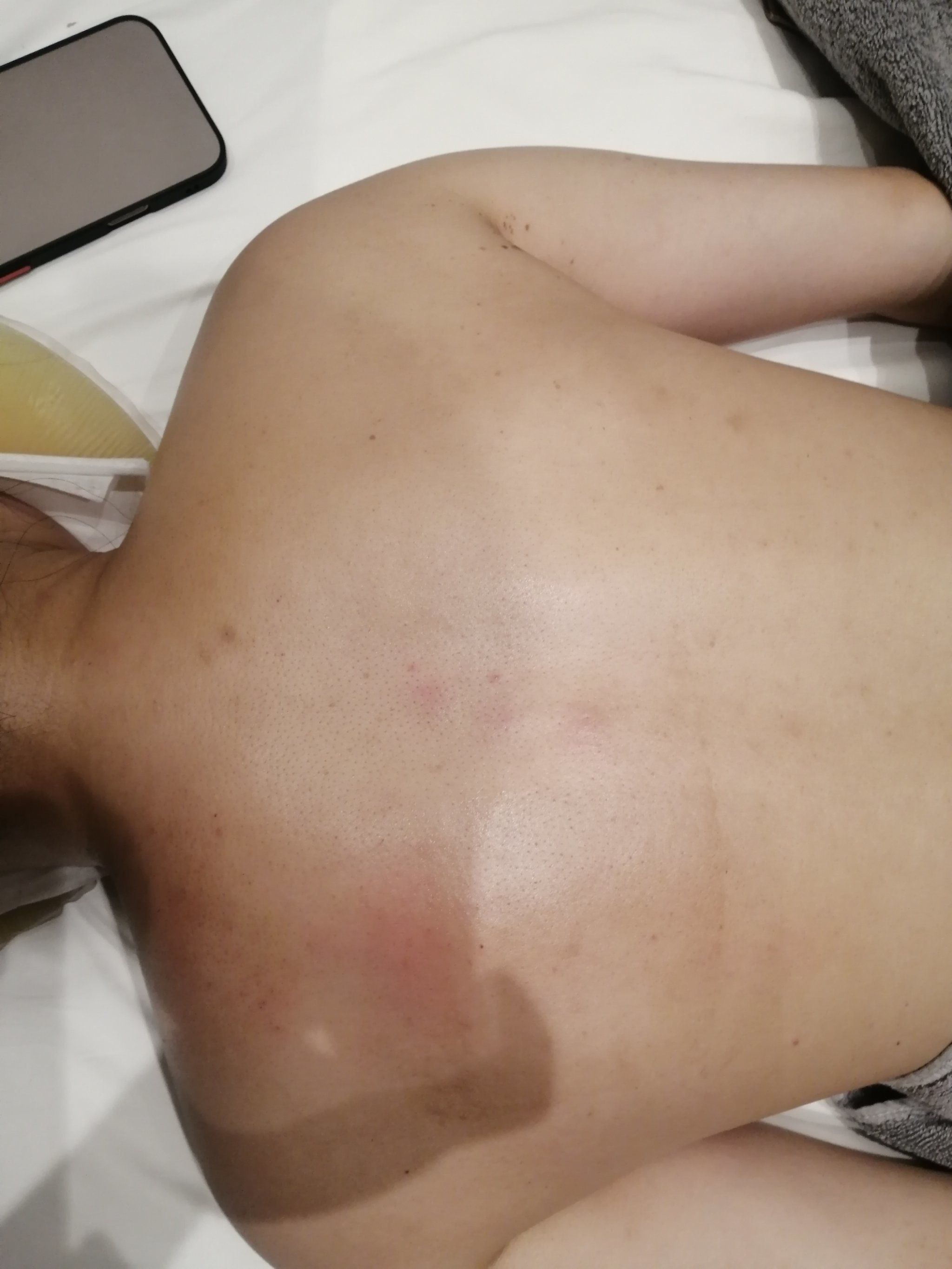 揭秘背部保养的小技巧
