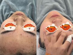 -skin79皮肤管理中心