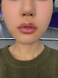 -天津健丽·去眼袋医疗美容机构