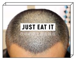 -大麦微针植发全国连锁