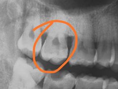 -爱贝口腔·牙周诊疗·种植修复中心