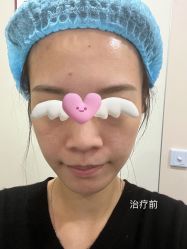 体验前-上海时光整形外科医院