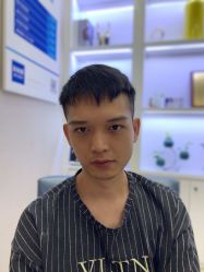 点击看大图 -大麦微针植发丨全国连锁
