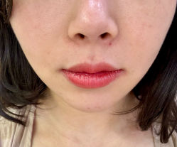 -JustHer宁波珈禾医疗美容医院