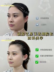 -Yestar艺星医疗美容医院