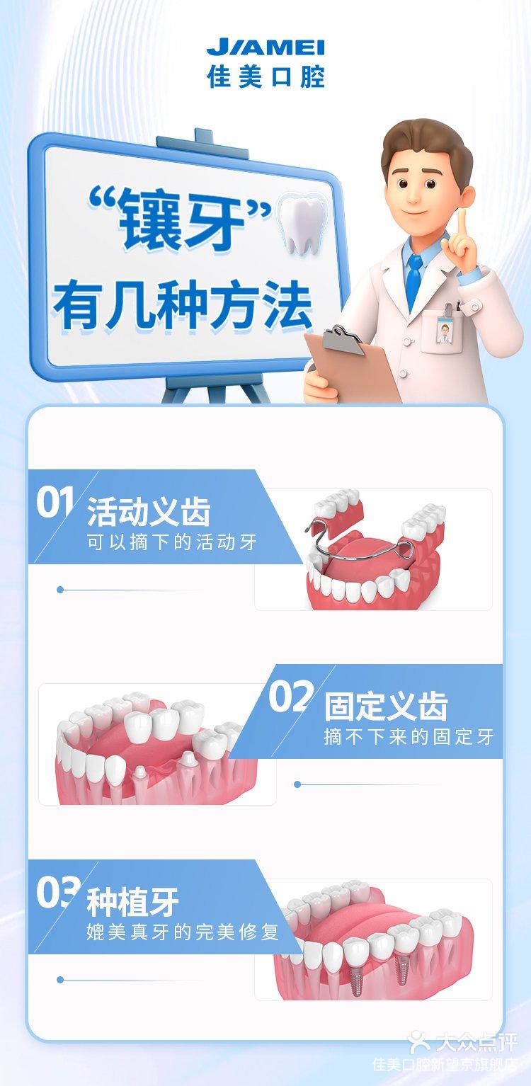 固定桥镶牙图片