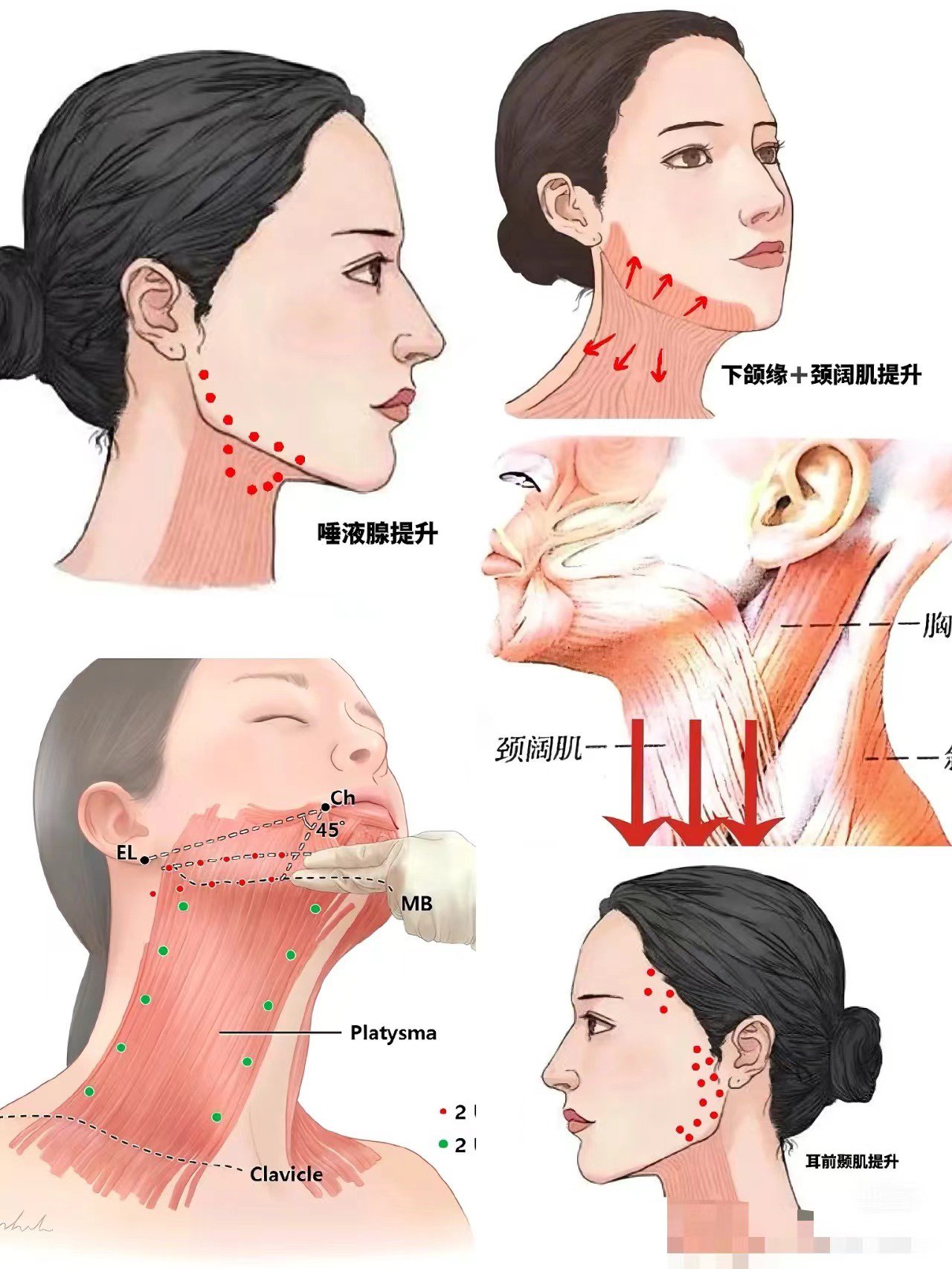 颞肌越来越大图片