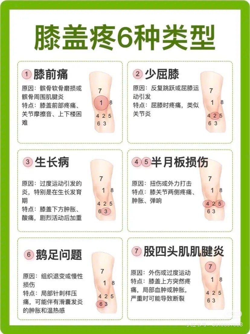 n- **半月板撕裂**:膝关节内的软骨损伤.
- **骨折*