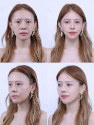 -广州美莱医疗美容医院