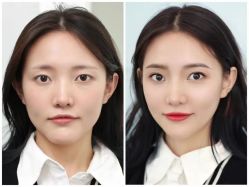 -安吉拉青春化管理中心