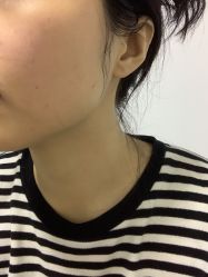体验后-智美品质医美
