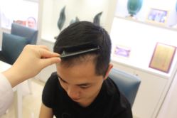 点击看大图 -大麦微针植发丨全国连锁