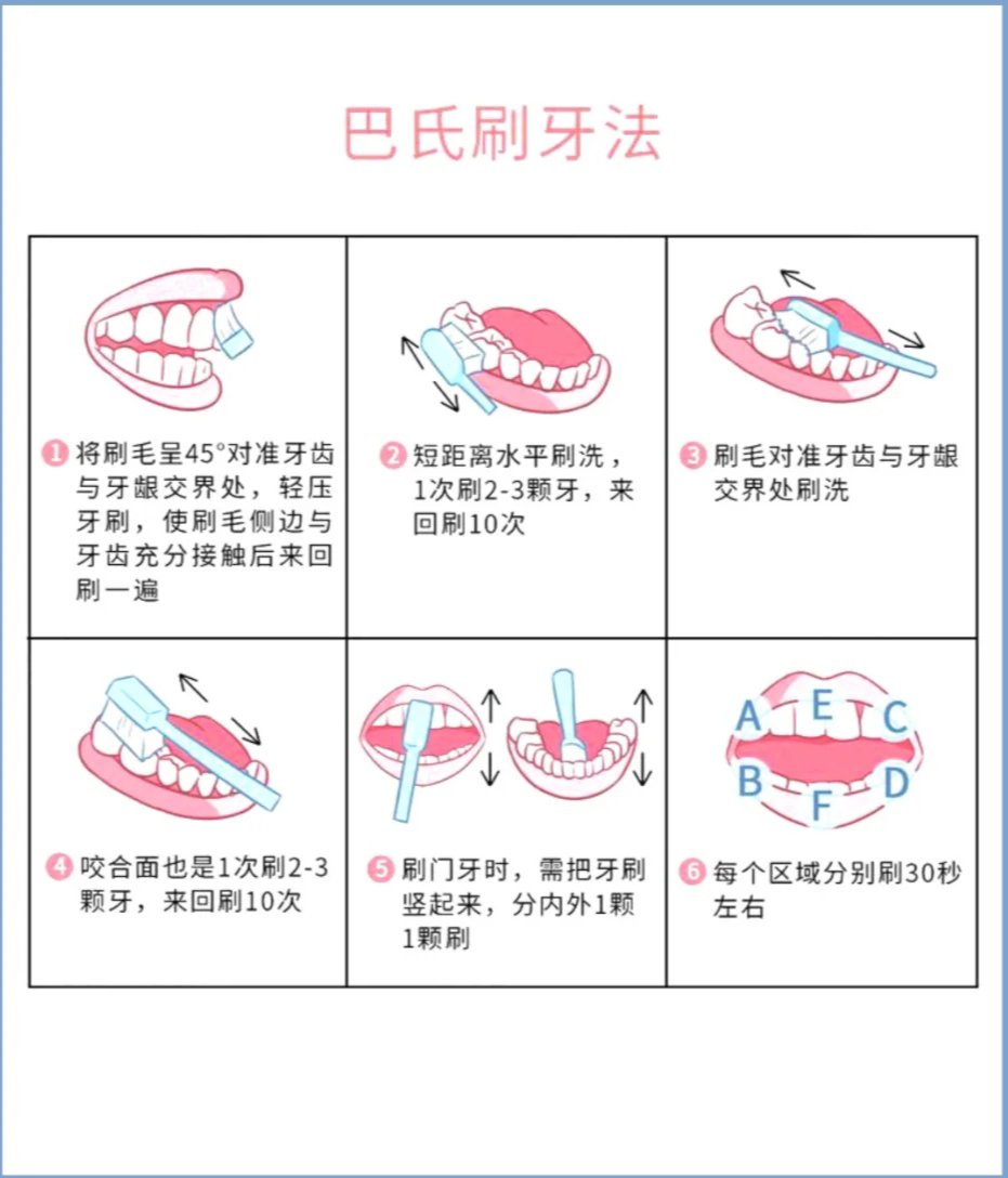 楔状缺损怎么治疗图片