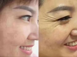 -香薇妮丝·定制减肥·身材管理