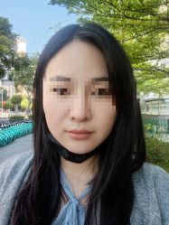 体验后-厦门美莱整形美容医院