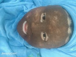 -百世玉芳专业祛痘