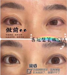 -LUNA皮相美·骨相美高级美感
