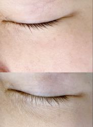 -天津健丽·去眼袋医疗美容机构