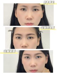 -杨益美学·野生眉半永久纹眉发际线