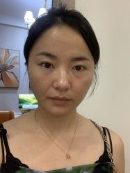 -广州健丽·去眼袋医疗美容机构