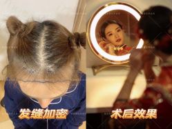 点击看大图 -熙朵美学植发连锁