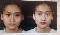 -贵阳美莱医疗美容整形医院