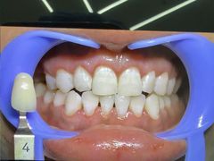 -极光口腔·矫正种植修复(锦江院区)