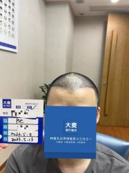 -大麦微针植发全国连锁