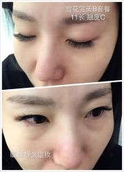 睫毛嫁接-光SPA科技美肤