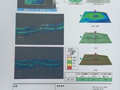 -大连何氏眼科医院
