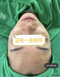 点击看大图 -苗方清颜·祛痘皮肤管理