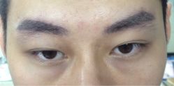 帅哥飘眉-平萍纹绣韩式半永久定妆