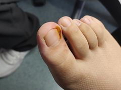 -新甲连锁灰指甲·甲沟炎·鸡眼(黑龙江路店)