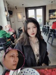 -北京米扬丽格医疗美容·联合丽格鼻整形中心