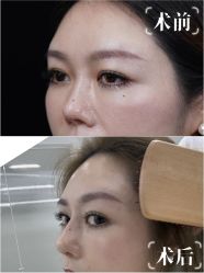-深圳艺星医疗美容医院