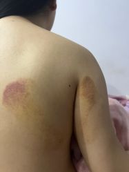 -洁铭新加坡医美