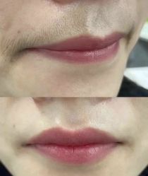 点击看大图 -植蔻妍倍儿专业脱毛·皮肤管理