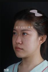 -北京米扬丽格医疗美容·联合丽格鼻整形中心