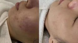 -尊尚柏丽美容SPA