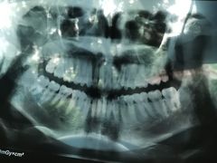 -同步齿科·数字化正畸种植口腔中心(前山店)