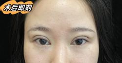 -素美医疗美容·西南眼鼻整形·修复基地