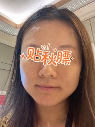 体验前-恒妍医美·韩国定制抗衰中心