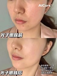 -AiCure 埃可儿·韩国医学皮肤管理